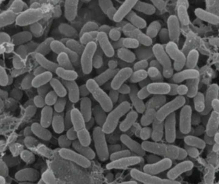 Le infezioni resistenti agli antibiotici nei pazienti COVID-19 stanno accelerando l'era post-antibiotica?